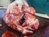 ventricular haemorrhage of brain